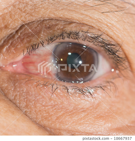 eye exam 18667937
