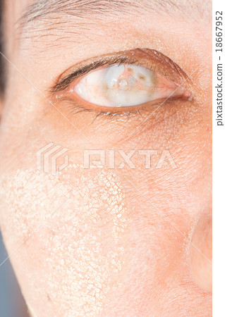 eye exam 18667952