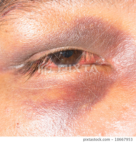 eye exam 18667953
