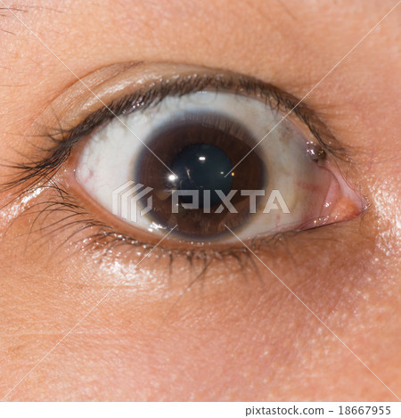 eye exam eye exam 18667955