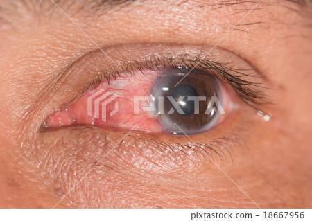 eye exam eye exam 18667956