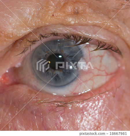 EYe exam EYe exam 18667981