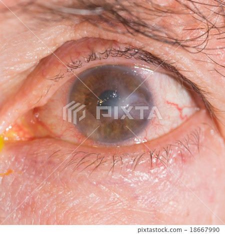 eye exam eye exam 18667990