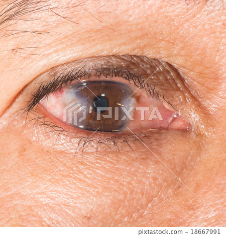 eye exam eye exam 18667991