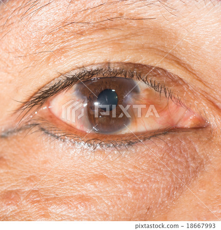 eye exam eye exam 18667993