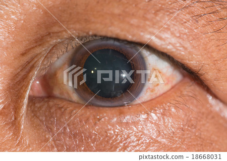 eye exam eye exam 18668031