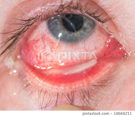 eye exam 18668251