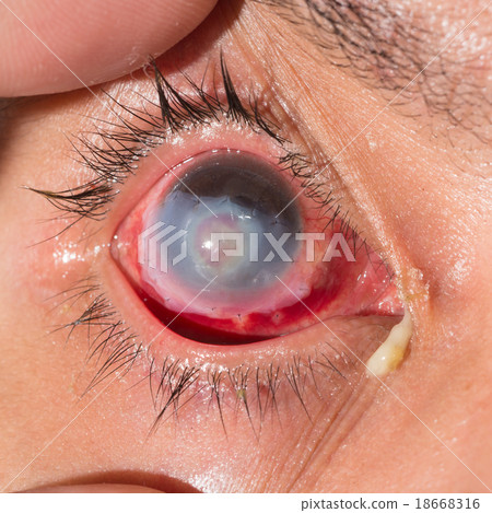 eye exam 18668316