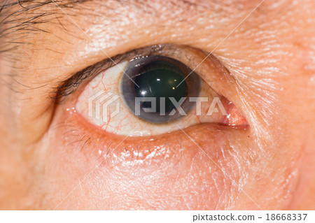 eye exam eye exam 18668337