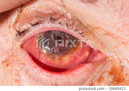 eye exam eye exam 18668421