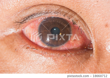 Eye exam Eye exam 18668712