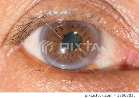 eye exam eye exam 18668833