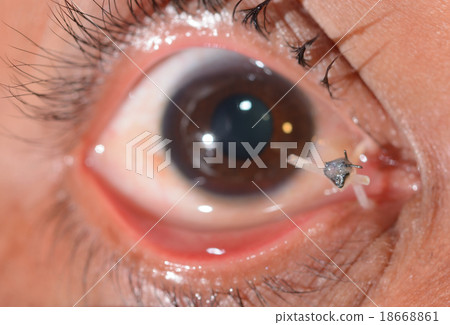 EYe exam EYe exam 18668861