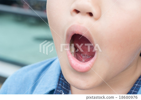 Tongue Tie 18680976