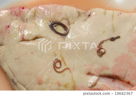 異尖線蟲 異尖線蟲 18682367