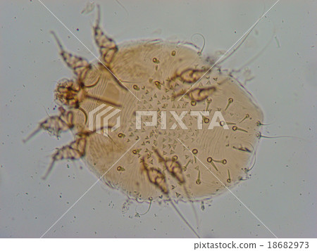 Human flea (Pulex irritans) 18682973