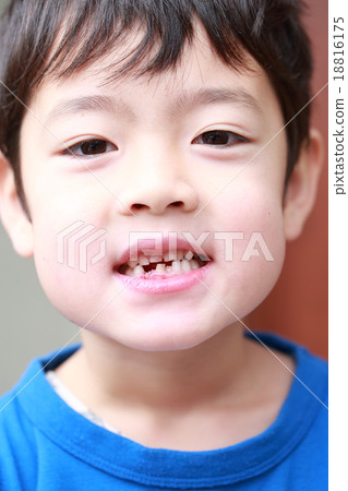 一個牙齒長大的男孩 一個牙齒長大的男孩 18816175