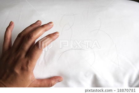 Image of hair loss 18870781