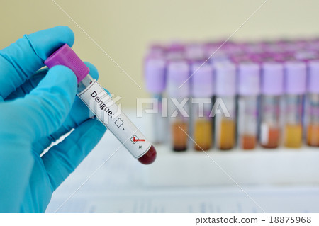 Dengue virus positive blood sample Dengue virus positive blood sample 18875968