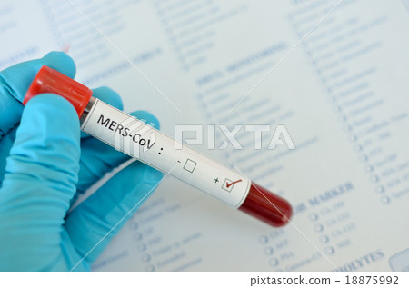 Blood sample with MERS virus positive 18875992