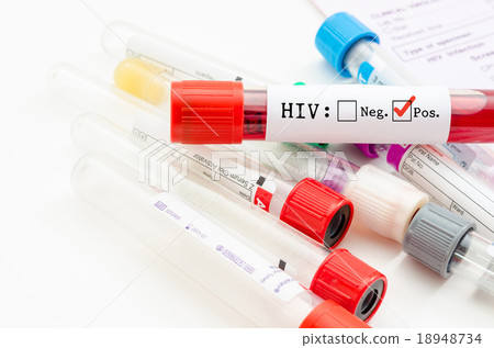 Sample blood collection tube with HIV test. 18948734