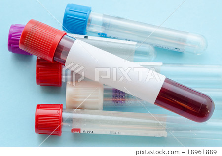 Stock Photo: Blood sample test and empty tube blood.