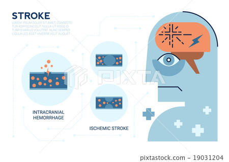 Stroke Brain Disease 19031204