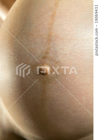 stomach stomach 19069431