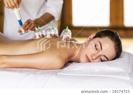 Woman with cupping treatment on back Woman with cupping treatment on back 19174725