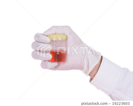 doctor's hand with bloody urine  19223603