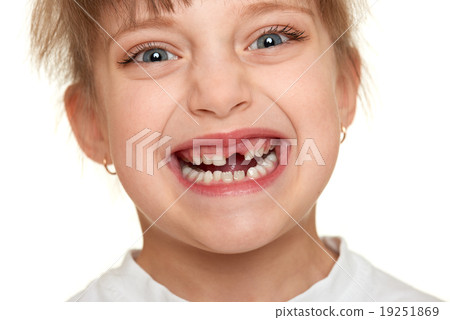 lost tooth girl face closeup lost tooth girl face closeup 19251869