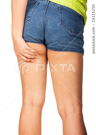 Fat thighs, cellulite of a teenage girl. Fat thighs, cellulite of a teenage girl. 19315250