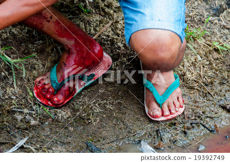 Man in flip flop shoes full of blood during a 19392749