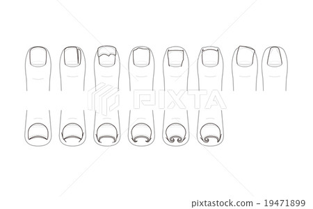 Foot trouble and rolled nail Foot trouble and rolled nail 19471899