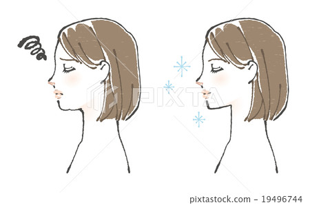 Before after illustration of a double chin women Before after illustration of a double chin women 19496744