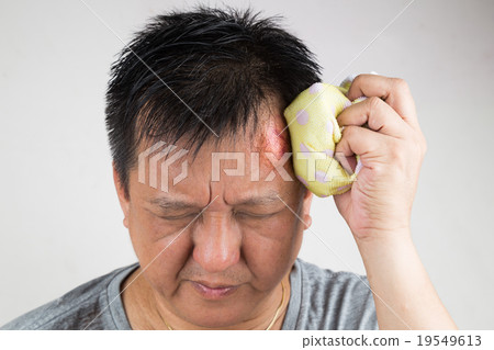 Man treating injured swollen forehead with icepack Man treating injured swollen forehead with icepack 19549613