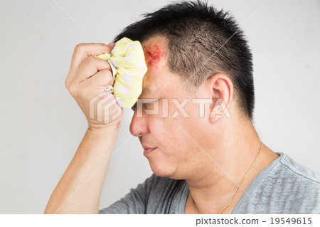 Man treating injured swollen forehead with icepack Man treating injured swollen forehead with icepack 19549615