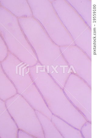 Thin skin of microscopic onions Thin skin of microscopic onions 19559100