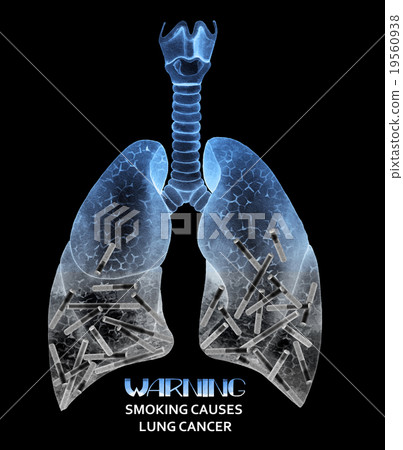 Watercolor  lungs full of cigarettes 19560938