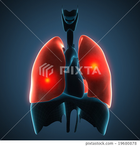 Disease Illustration Of Human Lungs. - Stock Illustration [19680878 ...