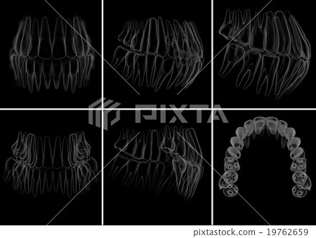 medical illustration of the tooth on  background 19762659