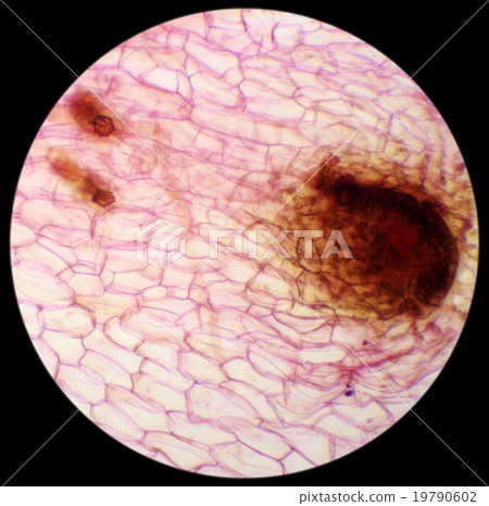 Micrograph of new sporophyte of fern leaf Micrograph of new sporophyte of fern leaf 19790602