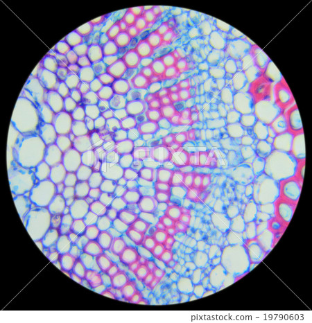Winter Jasmine leaf under a microscope 19790603