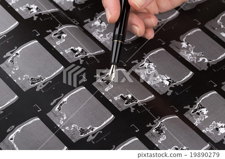 Series of images from a tomography 19890279