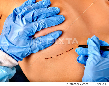 Doctor makes dotted line on female breast . 19899641