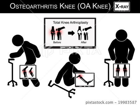Old man pain at his knee Old man pain at his knee 19983587