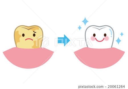 Teeth Whitening 20061264