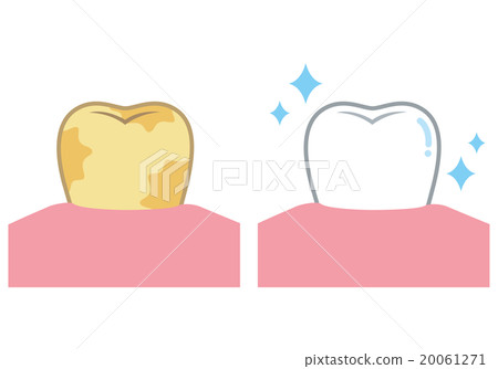 牙齒美白 20061271