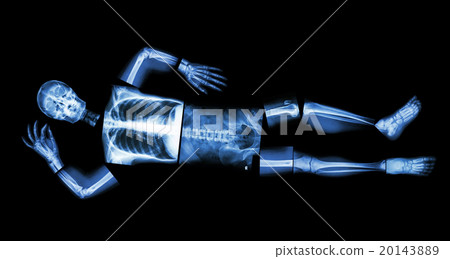 Human bone is sleeping Human bone is sleeping 20143889
