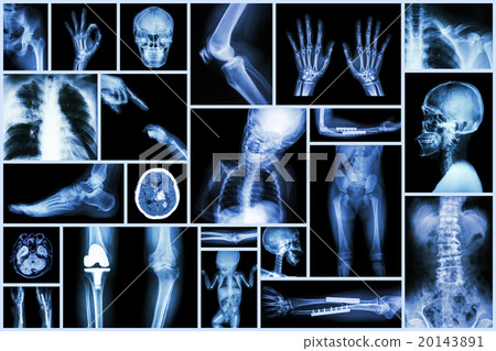 Collection X-ray multiple part of human 20143891